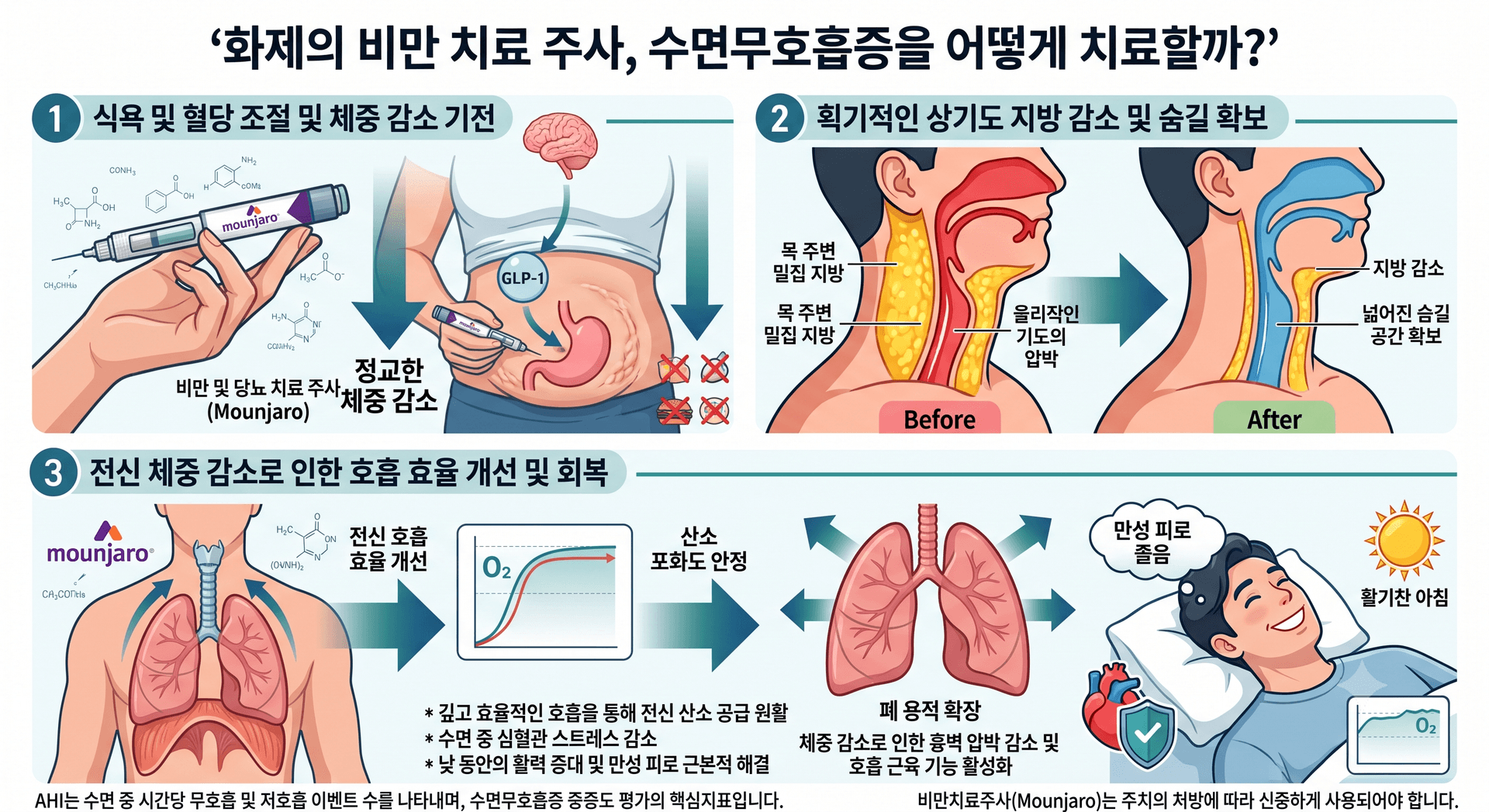 "살 빼는 주사가 코골이도 고친다?" 최근 승인된 비만 치료제의 수면무호흡증 개선 효과와 정밀 수면다원검사